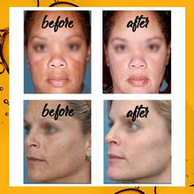 Load image into Gallery viewer, Dark Spot Curing Ampoule