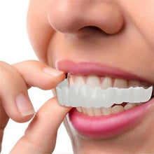 Load image into Gallery viewer, Perfect Smile Snap-On Braces
