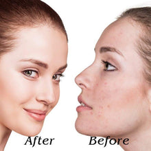 Load image into Gallery viewer, 5 in 1 LED Skin Tightening