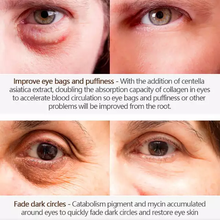 Load image into Gallery viewer, Magic Eye Cream - 28 seconds to remove eye bags / dark circles / eye wrinkles