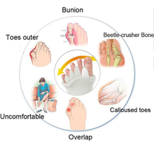 Load image into Gallery viewer, Bunion Relief Toe Socks