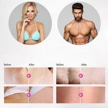 Load image into Gallery viewer, Laser Epilator Hair Removal