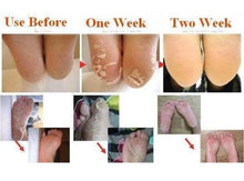 Load image into Gallery viewer, Deep Moisturizing & Exfoliating Feet Peel Mask (1 Pair Set)