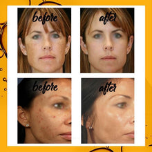 Load image into Gallery viewer, Dark Spot Curing Ampoule
